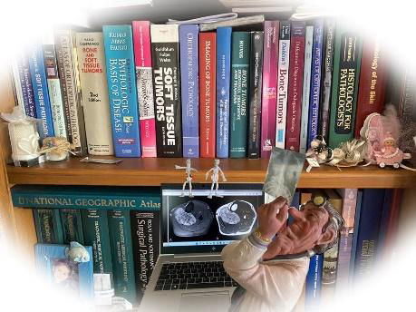 Yumuşak doku tümörleri