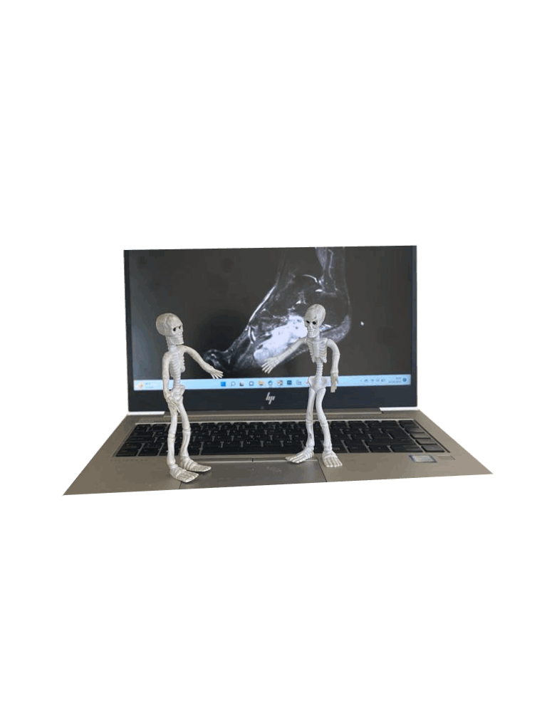 Yumuşak doku tümörleri